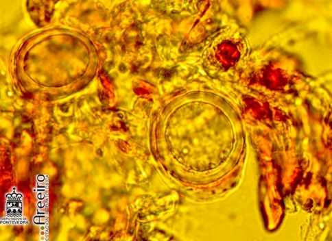 Plasmopara vitícola (Mildiu de la viña) - huevos de invierno vistos al microscopio.jpg